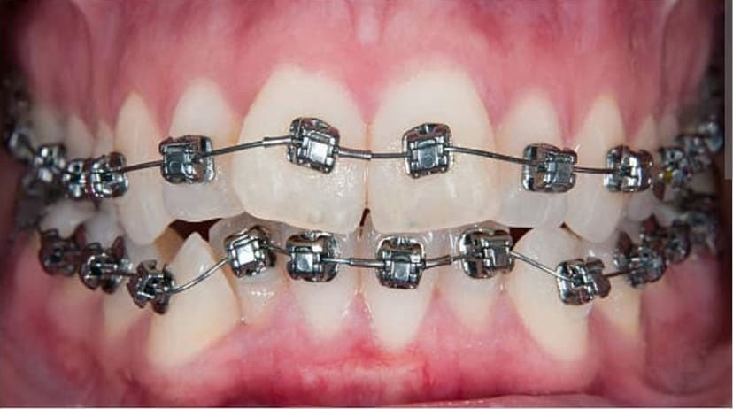 Before treatment - Patient 1